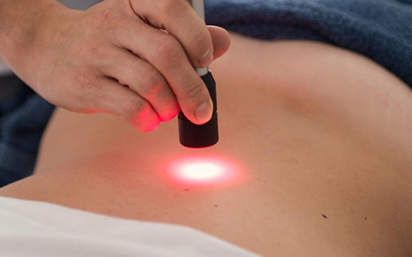 Laserterapia 1