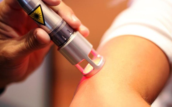 Laserterapia 3